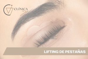 Lifting de Pestañas