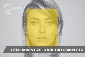 Depilación Láser Rostro Completo