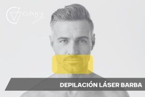 Depilación Láser Barba
