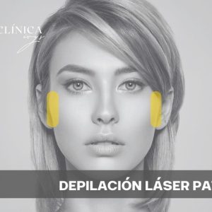Depilación Láser Patillas