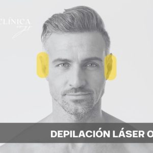 Depilación Láser Orejas
