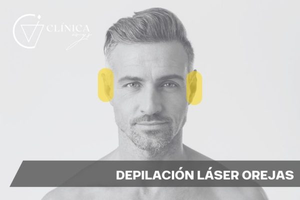 Depilación Láser Orejas
