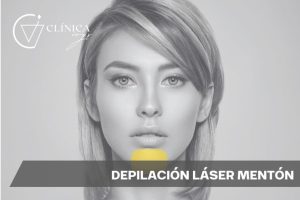 Depilación Láser Mentón