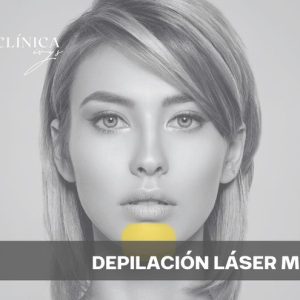 Depilación Láser Mentón