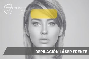 Depilación Láser Frente