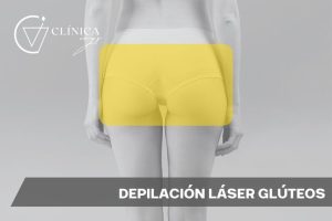 Depilación Láser Glúteos
