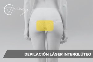 Depilación Láser Interglúteo