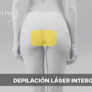 Depilación Láser Interglúteo
