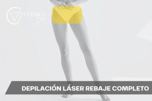 Depilación Láser Rebaje Completo