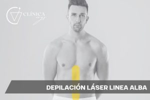 Depilación Láser Línea Alba