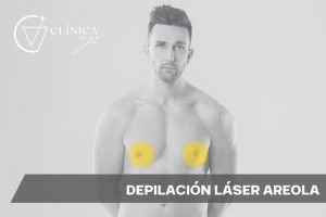 Depilación Láser Areola